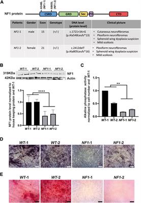 Generation of heterozygous and homozygous NF1 lines from human-induced pluripotent stem cells using CRISPR/Cas9 to investigate bone defects associated with neurofibromatosis type 1